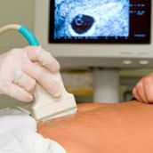 Equipo de ecografía en el embarazo