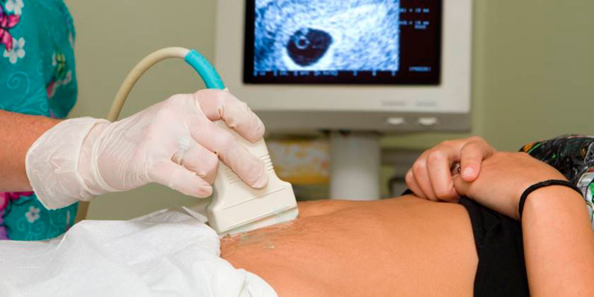 Equipo de ecografía en el embarazo