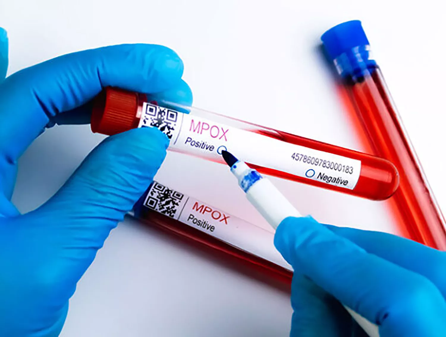 Analítica viruela del mono Laboratorio