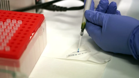 Lara Sanoguera Miralles, investigadora en el Grupo de Splicing y susceptibilidad al Cáncer del Instituto de Biología y Genética Molecular (IBGM) de Valladolid