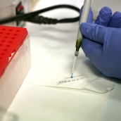 Lara Sanoguera Miralles, investigadora en el Grupo de Splicing y susceptibilidad al Cáncer del Instituto de Biología y Genética Molecular (IBGM) de Valladolid