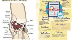 Resultado de la encuesta sobre el libro de lectura que Vox pide retirar del colegio de Fabero.