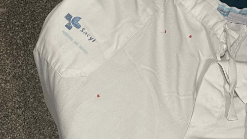 Uniforme del Hospital del Bierzo con manchas.