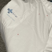 Uniforme del Hospital del Bierzo con manchas.