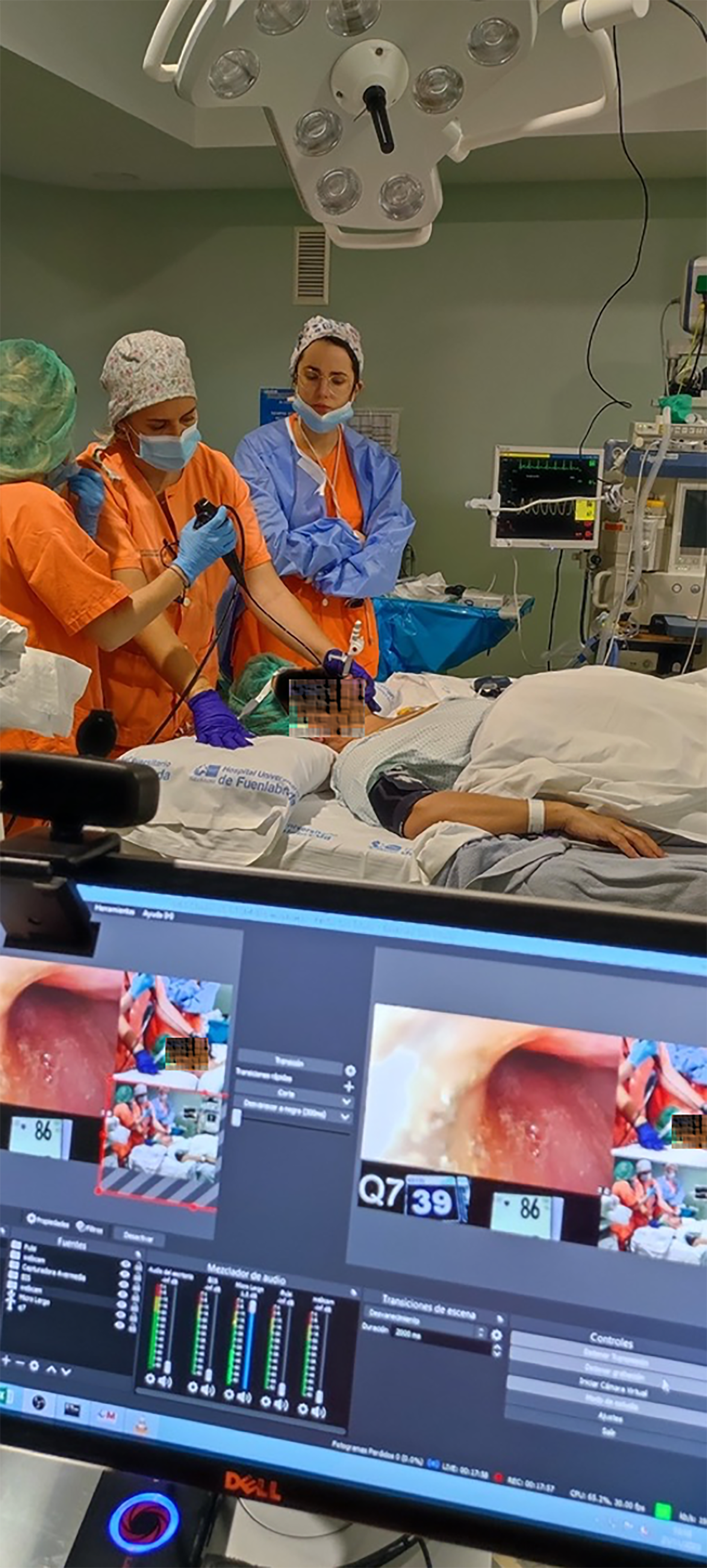 ICAL . Somnoscopia usando el Selector de Avance Mandibular (SAM)