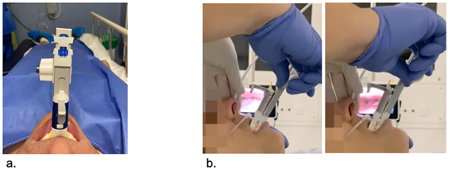 ICAL . Dispositivo SAM desarrollado por la investigadora ponferradina Patricia Fernández Sanjuán