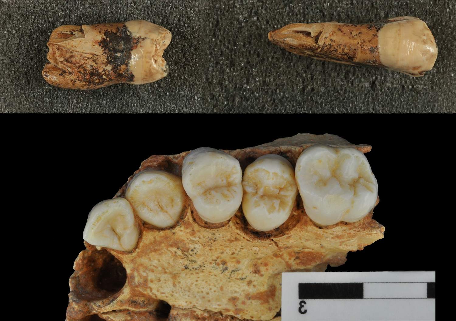 Descubrimientos dentales en Atapuerca