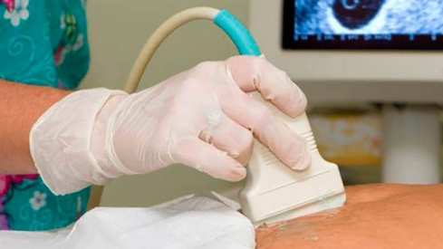 Aborto Castilla y León | El Gobierno propondrá incluir el derecho al aborto en la Constitución