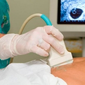 Aborto Castilla y León | El Gobierno propondrá incluir el derecho al aborto en la Constitución