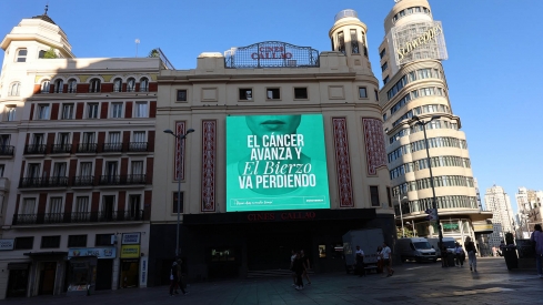 Oncobierzo en Callao Madrid