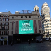 Oncobierzo en Callao Madrid