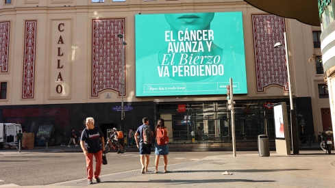 Oncobierzo en Callao Madrid