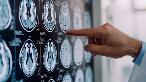 Una IA predice el riesgo de mas de mil enfermedades con decadas de antelacion