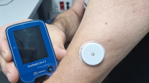 Un paciente de la Gasbi con el medidor de glucosa