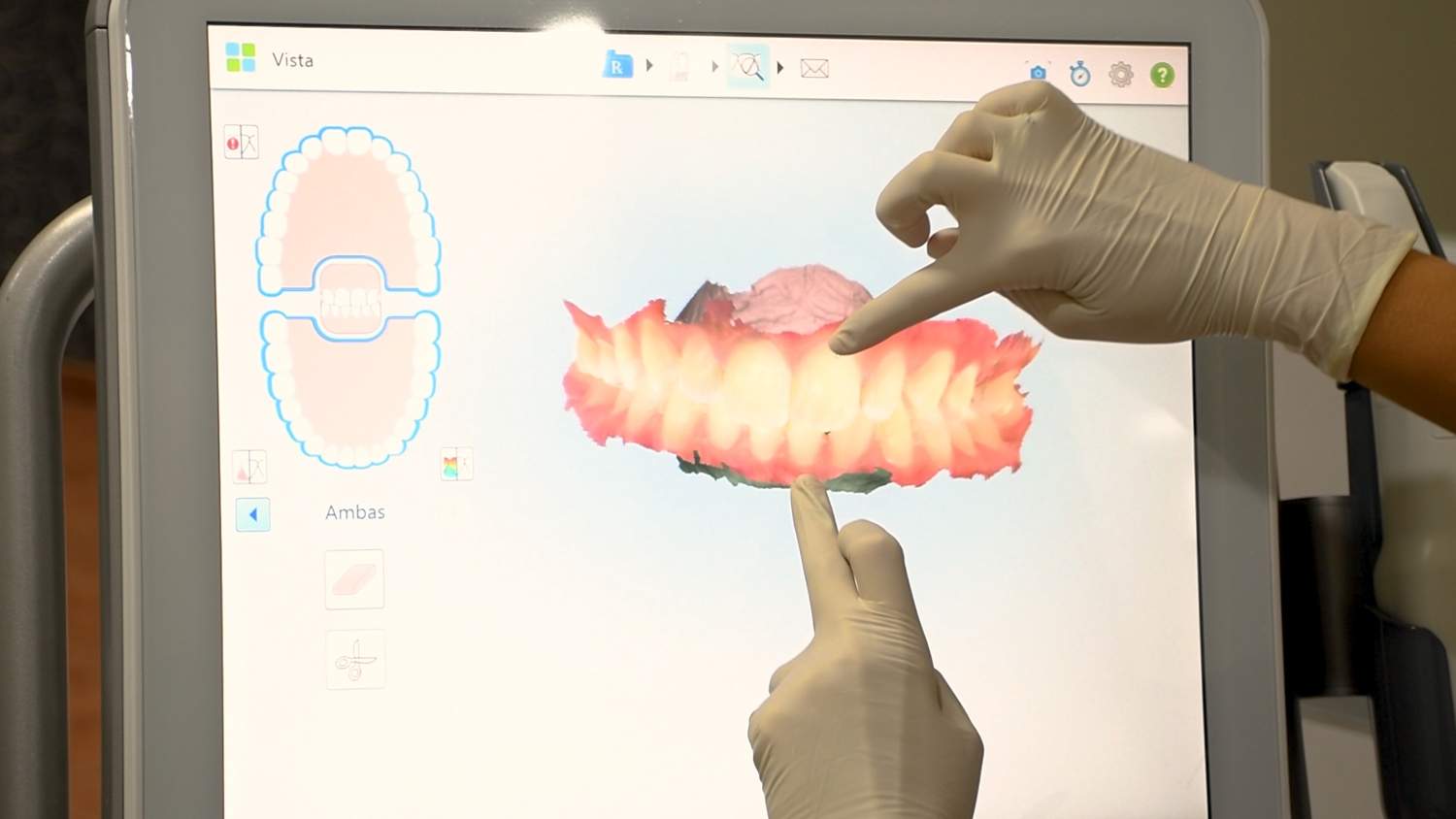 invisalign en Dentomedic (5)