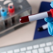 Un análisis genético de sangre para una detección precoz del Párkinson