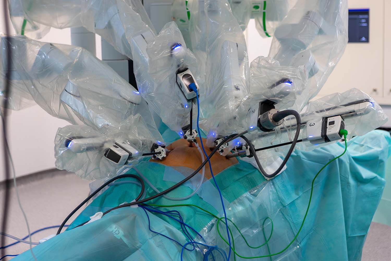 Cirugia robótica en cyl