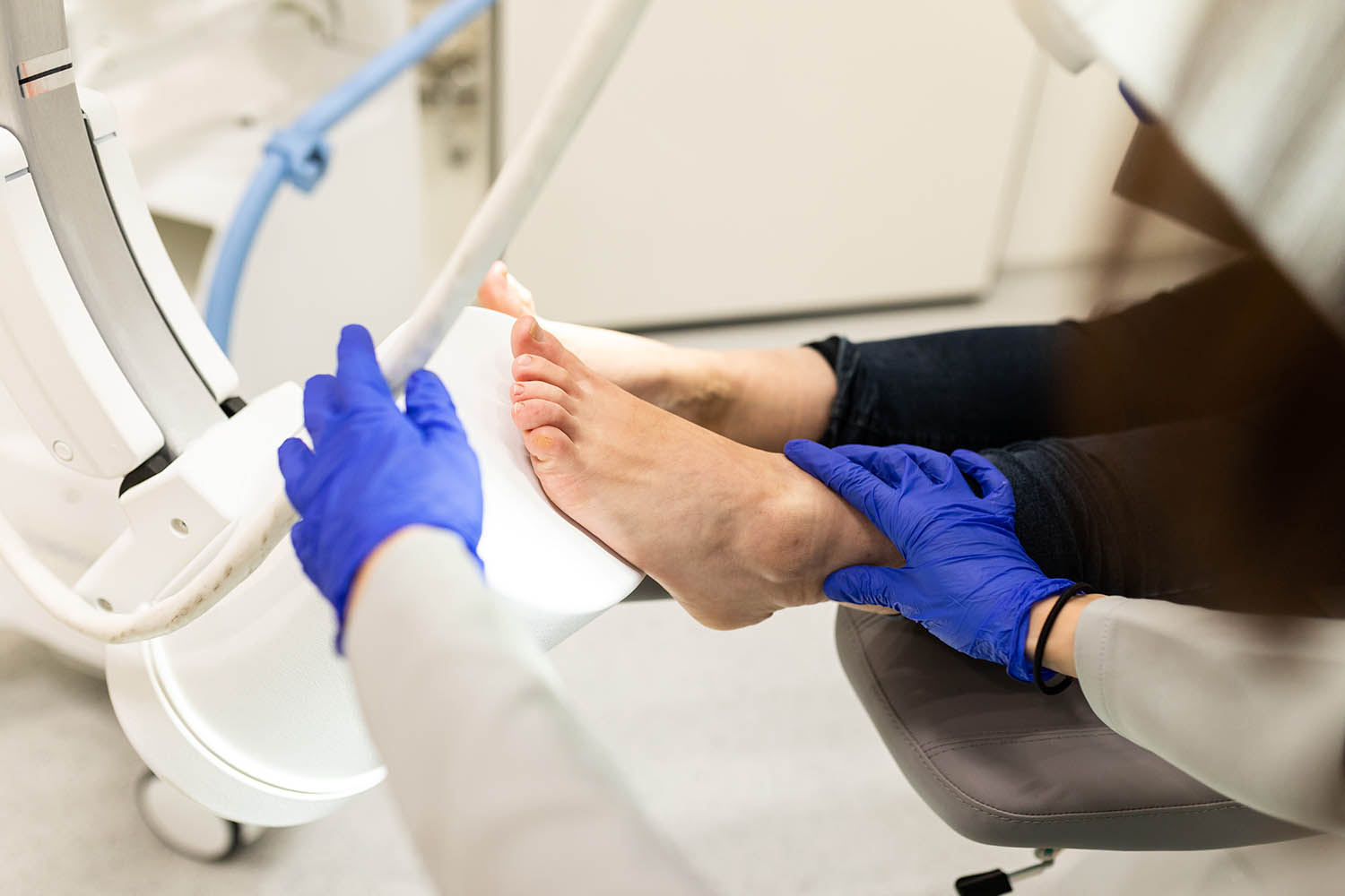 Úlcera del pie diabético Úlcera del pie diabético