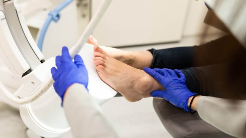 Úlcera del pie diabético Úlcera del pie diabético