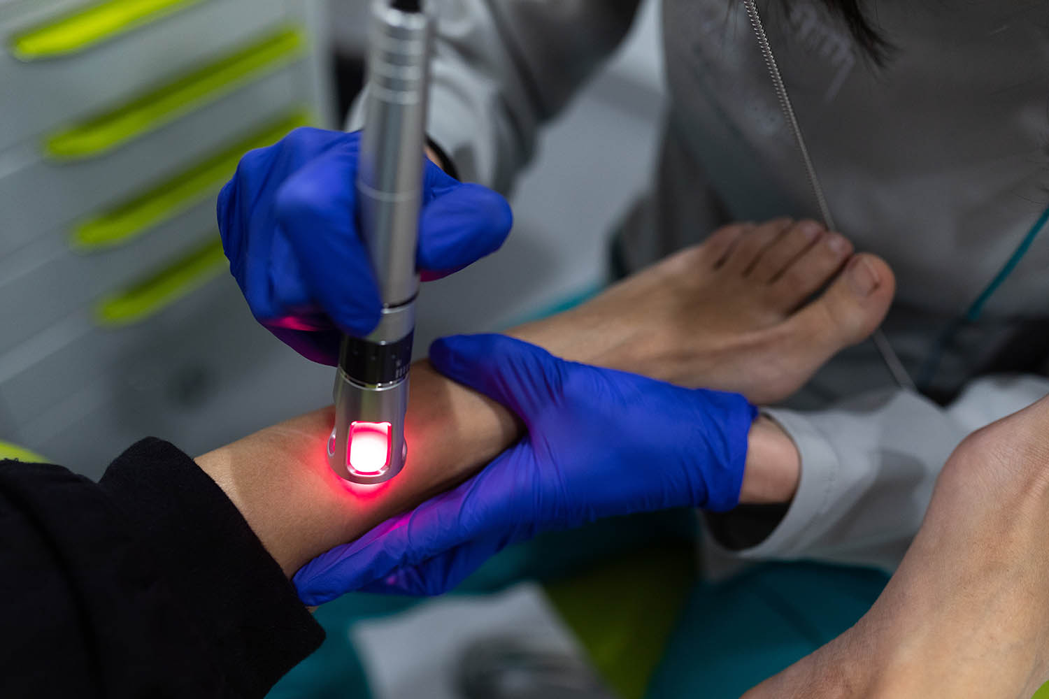 Úlcera del pie diabético. Úlcera del pie diabético.