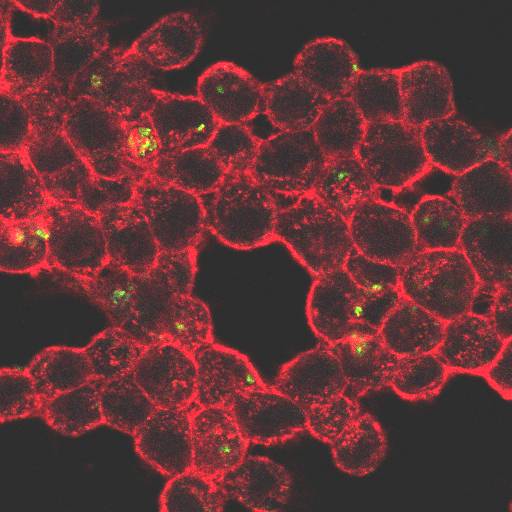 Macrófagos (en rojo sus filamentos de actina) con Rhodococcus equi intracelular en verde