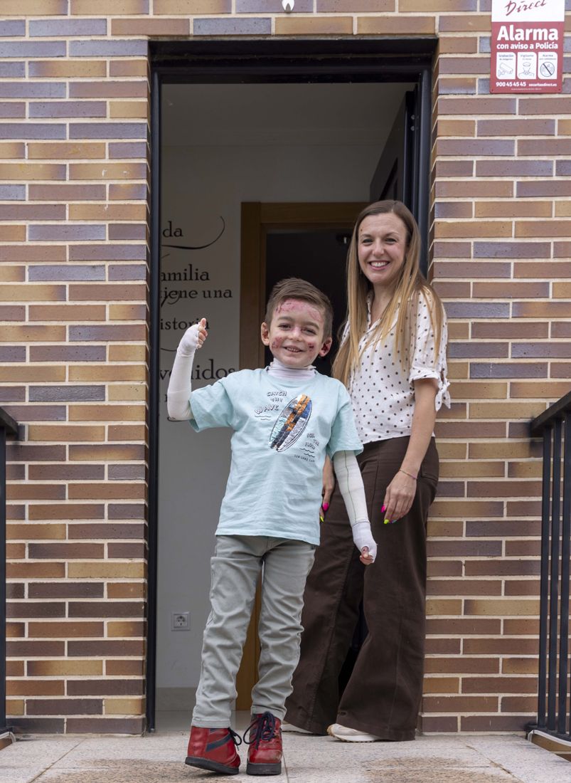 David Arranz / ICAL . El pequeño Javi Gallo, de seis años, convive desde su nacimiento con la enfermedad conocida como piel de mariposa. En la imagen con su madre, Carolina Gallo, en su casa.