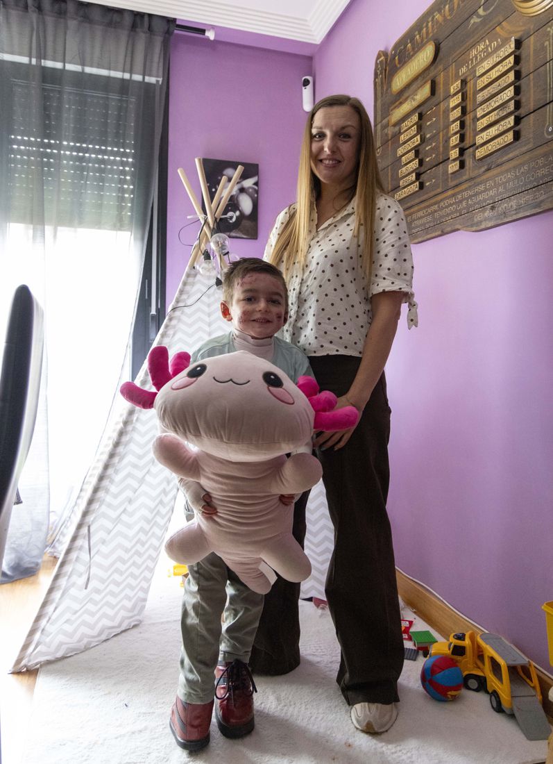 David Arranz / ICAL . El pequeño Javi Gallo, de seis años, convive desde su nacimiento con la enfermedad conocida como piel de mariposa. En la imagen con su madre, Carolina Gallo, en su casa.