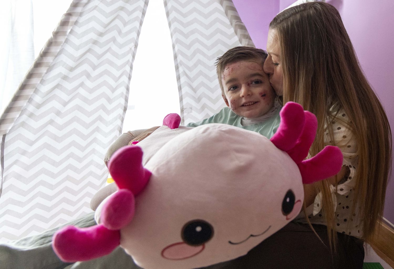 David Arranz / ICAL . El pequeño Javi Gallo, de seis años, convive desde su nacimiento con la enfermedad conocida como piel de mariposa. En la imagen con su madre, Carolina Gallo, en su casa.