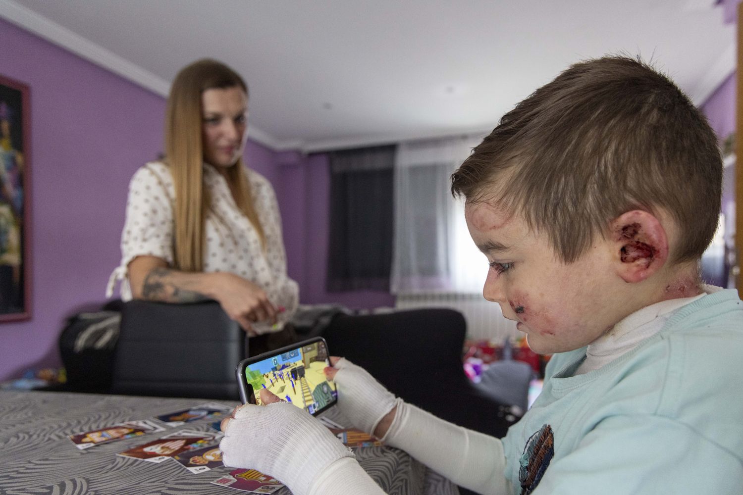 David Arranz / ICAL . El pequeño Javi Gallo, de seis años, convive desde su nacimiento con la enfermedad conocida como piel de mariposa. En la imagen con su madre, Carolina Gallo, en su casa.