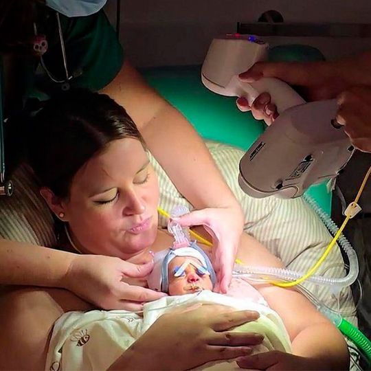 El Hospital 12 de Octubre desarrolla mascarillas nasales en 3D para ayudar a respirar a bebes prematuros